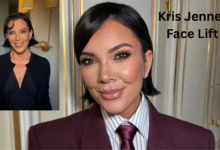Kris Jenner Face Lift