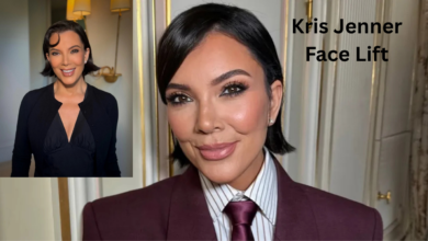 Kris Jenner Face Lift