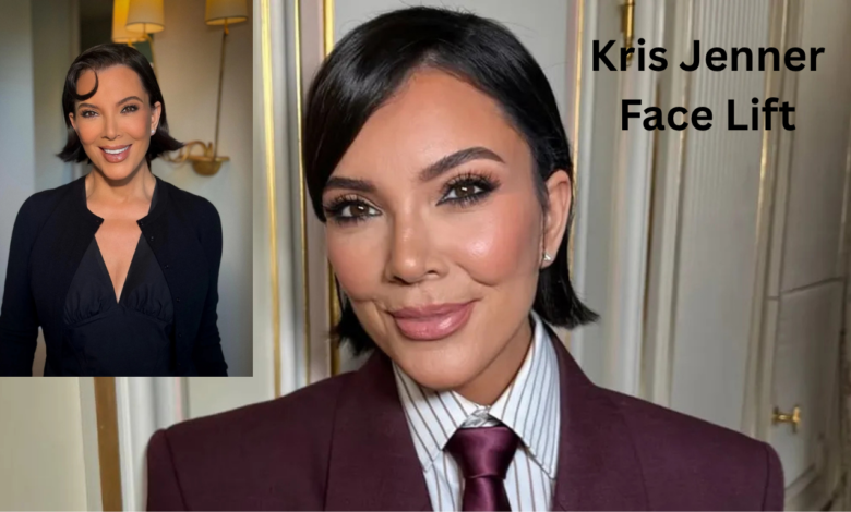Kris Jenner Face Lift