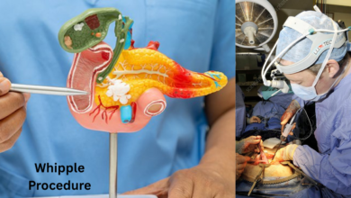 Whipple Procedure
