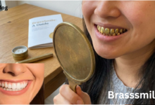 Brasssmile